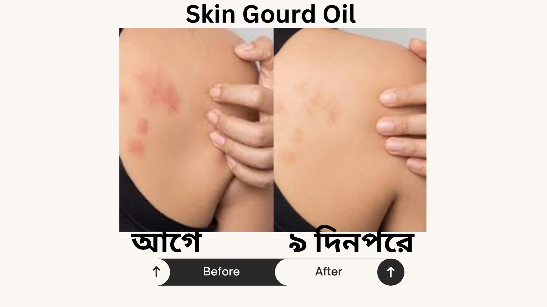 Anti Itch Oil 5