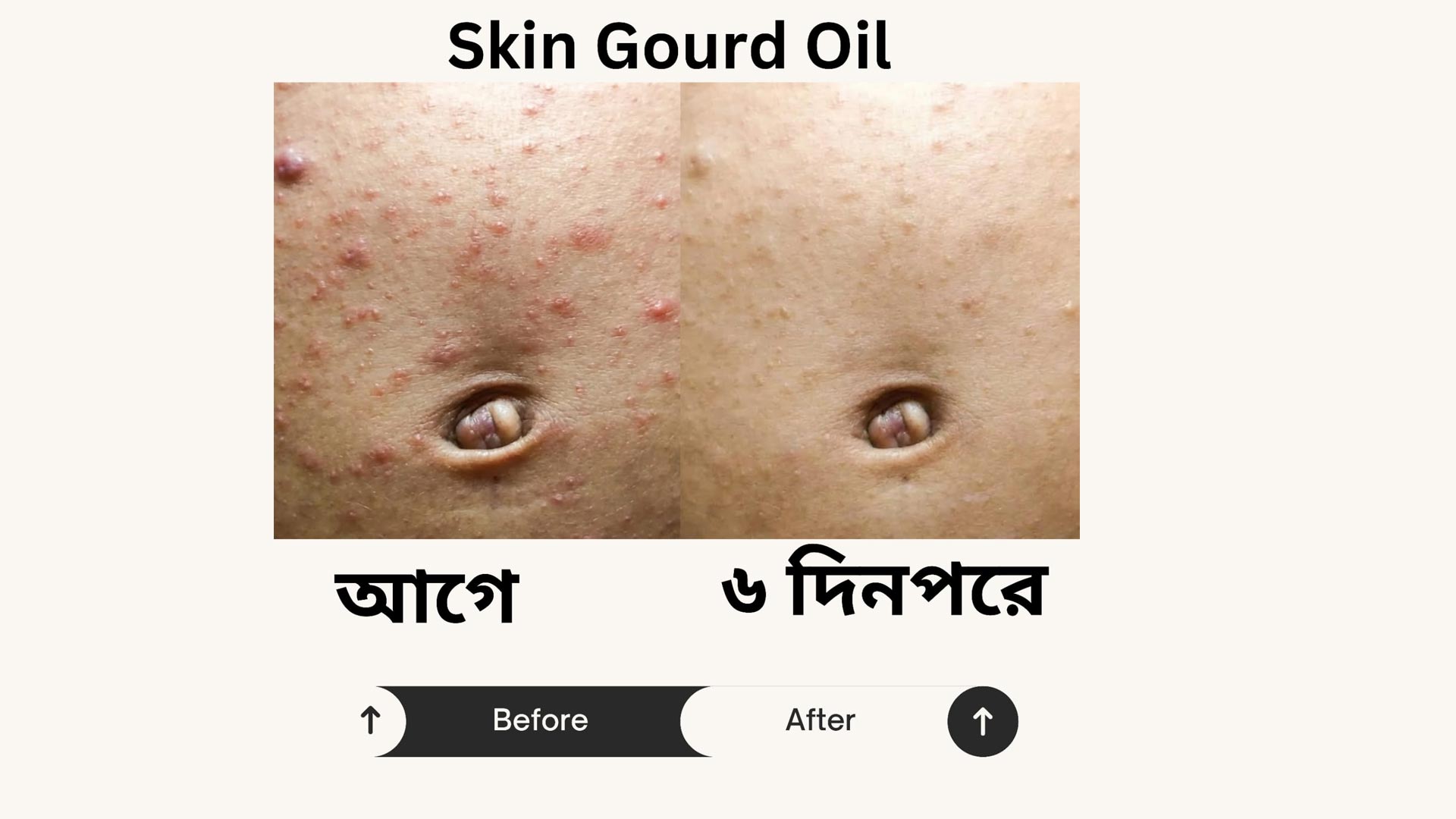Anti Itch Oil 1