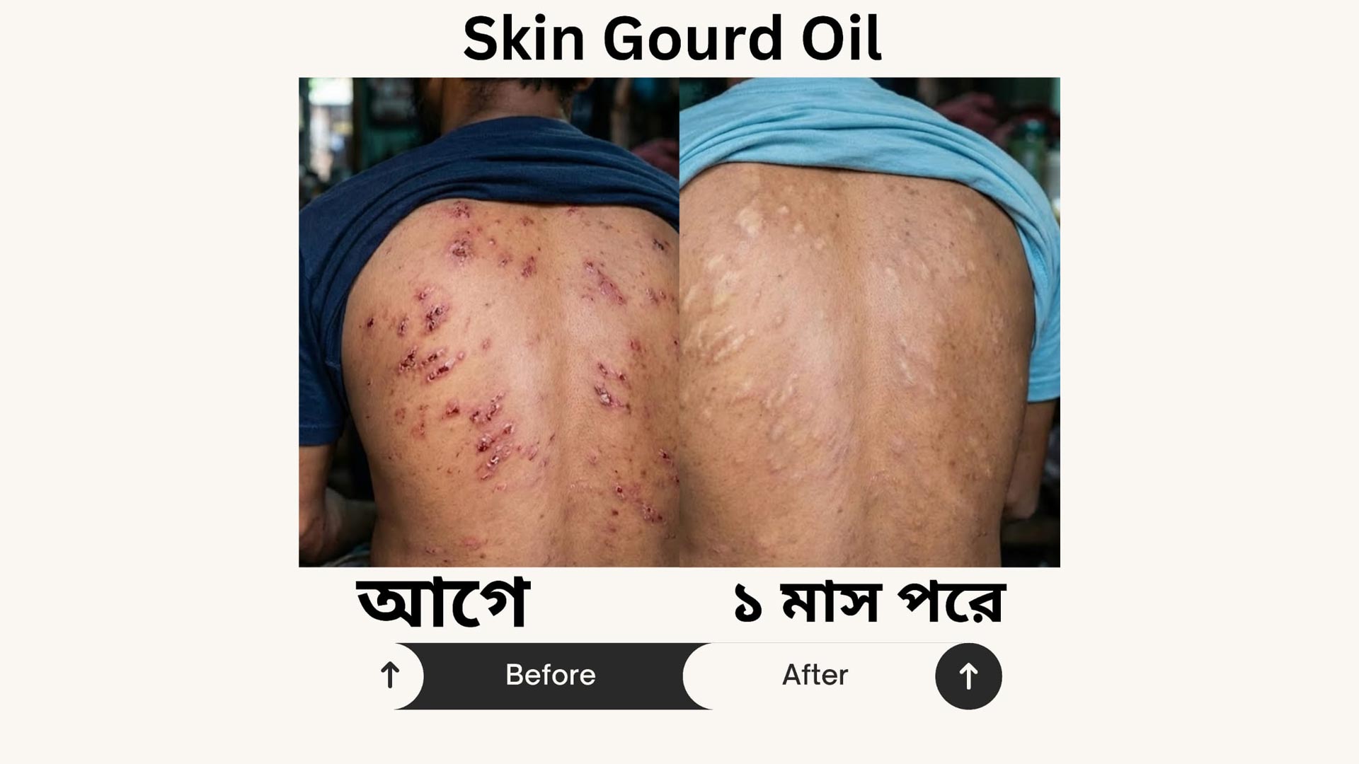 Anti Itch Oil 3