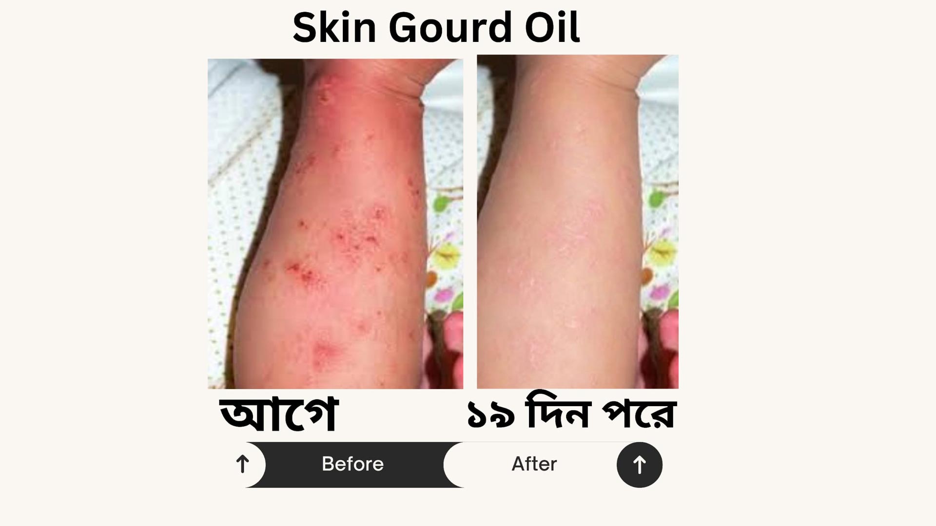 Anti Itch Oil 2