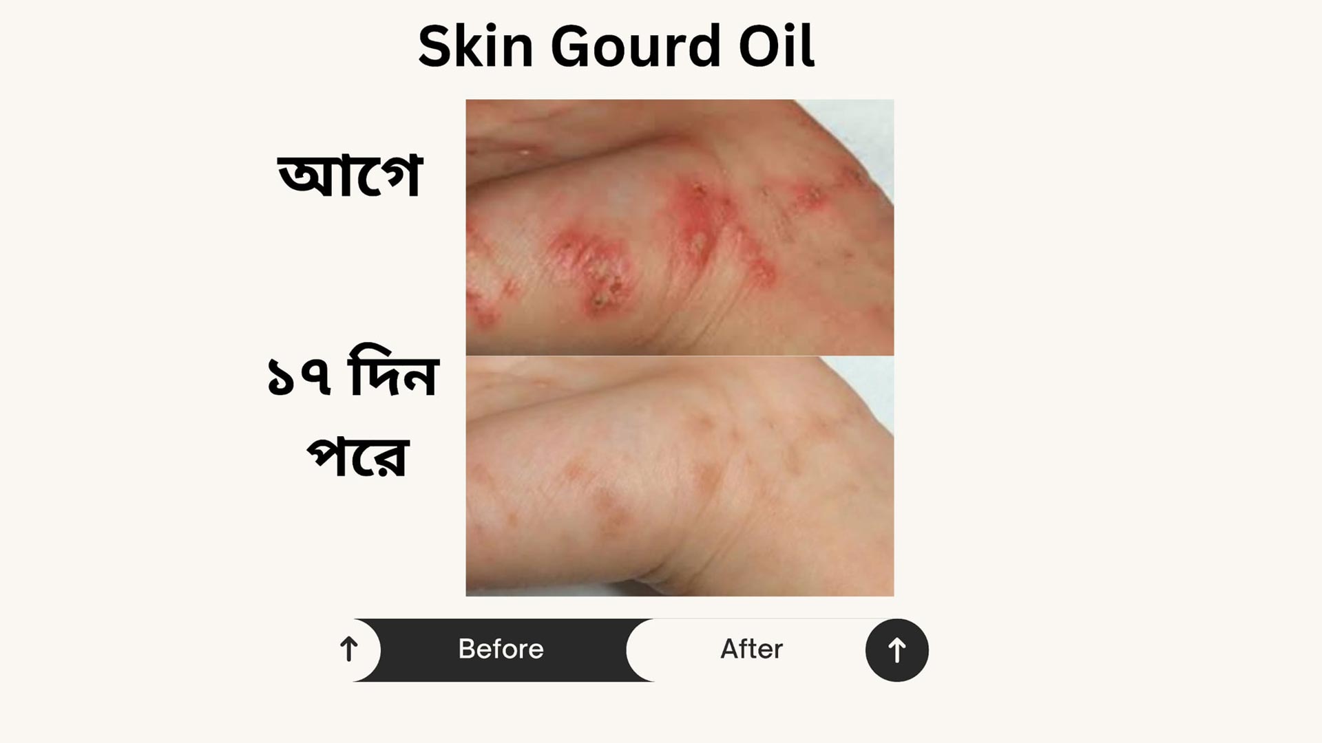 Anti Itch Oil 4